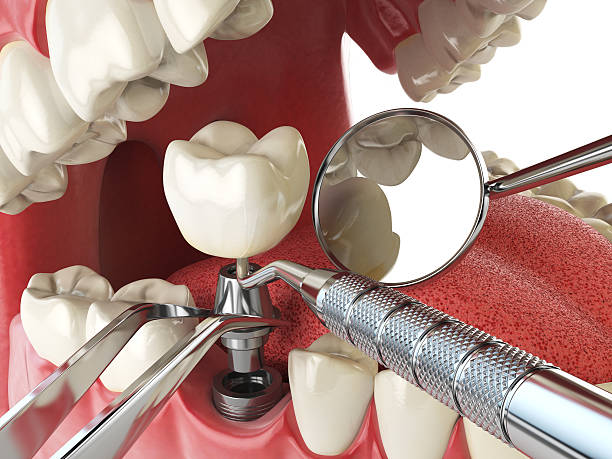 Best Emergency Gum Treatment in North Lima, OH